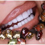 Cum îți alegi un medic stomatolog în București?