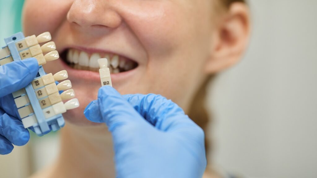 dinti ficsi in 24 ore